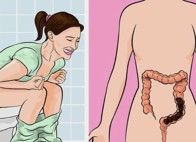 Does Kratom Cause Constipation? 1 kratom constipation